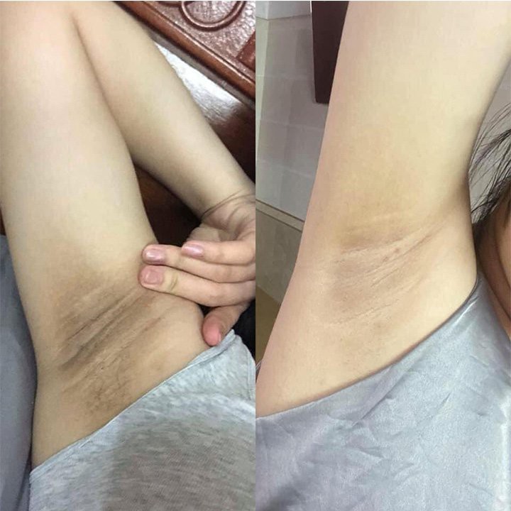 (CHÍNH HÃNG)💝FREESHIP💝 KEM  LÀM TRẮNG NÁCH BẸN MÔNG GCELL HÀN QUỐC | BigBuy360 - bigbuy360.vn