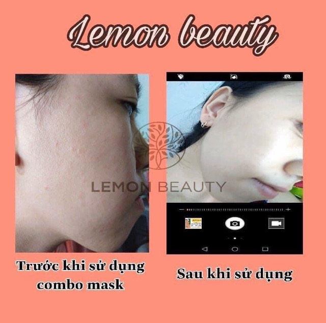 Lemonmask (mask khổ qua rừng và mask tảo biển)