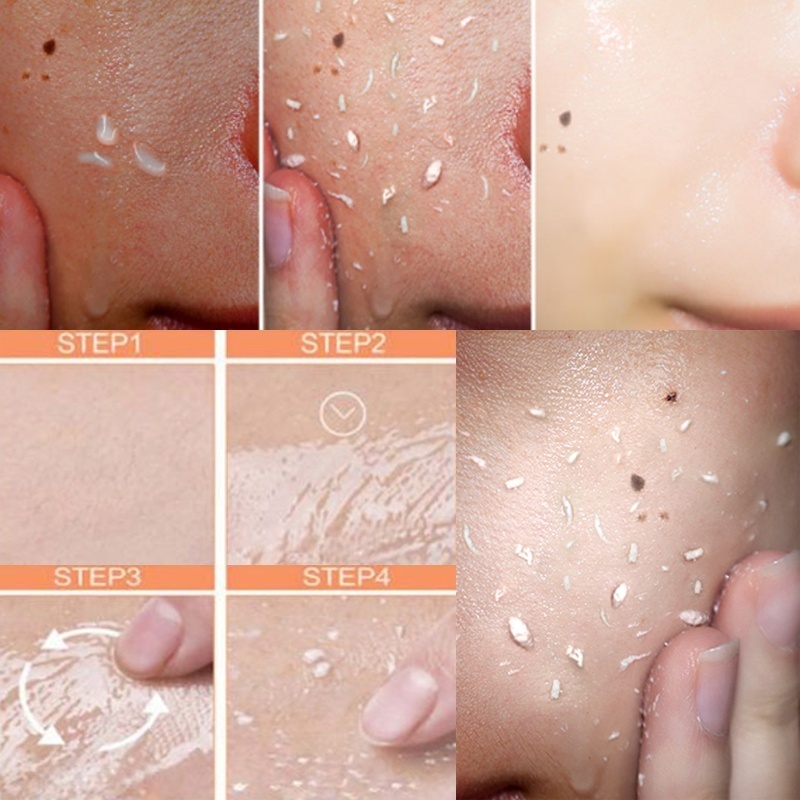 Gel Tẩy Tế Bào Chết 30g Chứa Hyaluronic Acid Giúp Dưỡng Ẩm Và Chống Lão Hóa Hiệu Quả