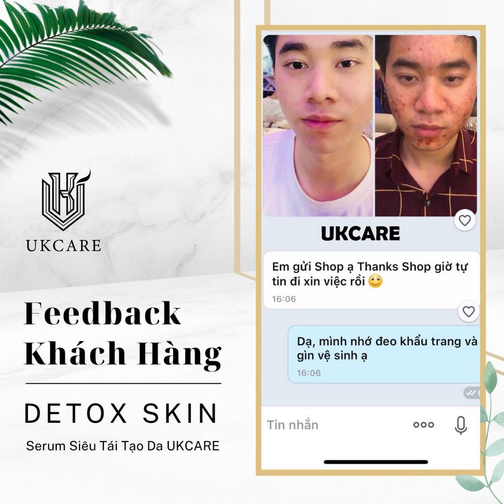 DETOX SKIN – SẠCH MỤN, SẠCH KHUẨN UKCARE | BigBuy360 - bigbuy360.vn