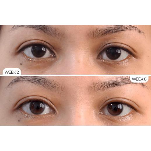 [ BILL CHÍNH HÃNG] Serum mờ thâm, giảm bọng mắt The Ordinary Caffein Solution 5% + EGCG | BigBuy360 - bigbuy360.vn