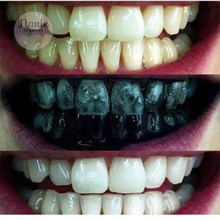 Bột Trắng Răng Than Tre Hoạt Tính
