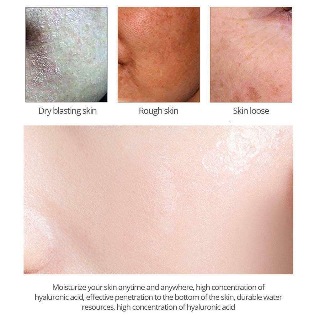 [Hàng mới về] Kem dưỡng ẩm làm trắng da loại bỏ nám và tàn nhang hiệu quả C1C8