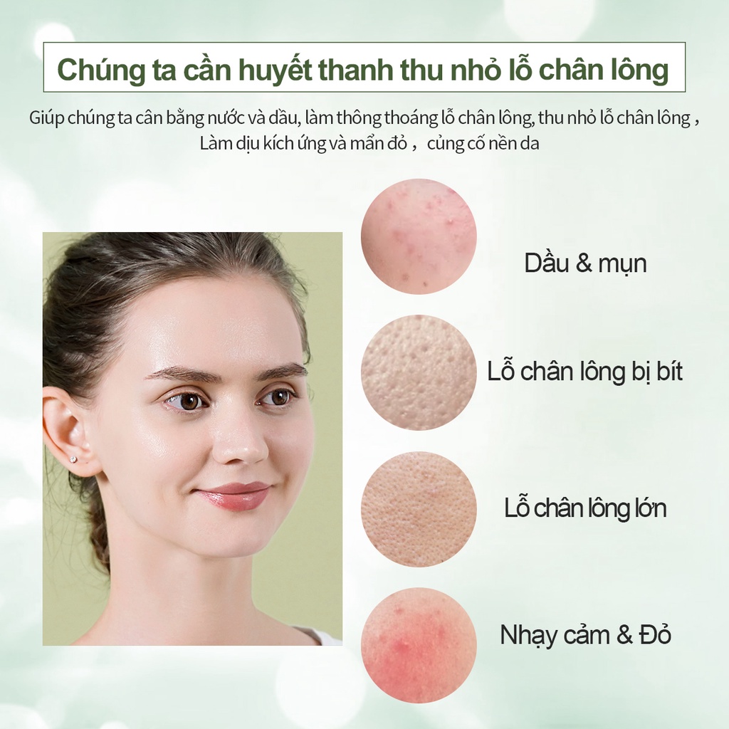 Tinh chất Youngbook thu nhỏ lỗ chân lông kiểm soát dầu làm mịn da thể tích 15ml | BigBuy360 - bigbuy360.vn