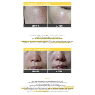 Tinh chất dưỡng trắng Miguhara