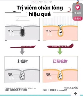 Dây kì lưng Silicon