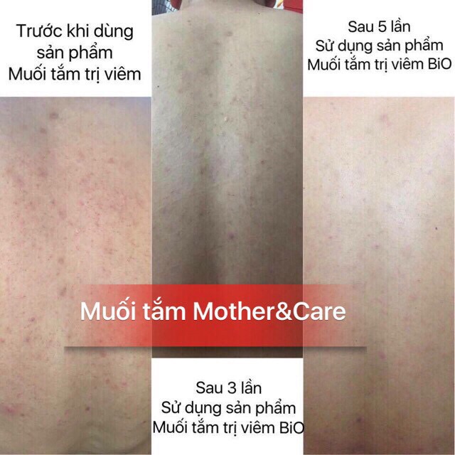 Muối tắm thảo dược Mother&care phiên bản đặc biệt