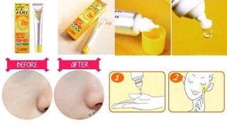 serum vitamin C