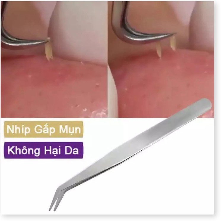 Nhíp lấy mụn 👉BH 1 THÁNG 👈   Cây nặn mụn chiều dài 8.7 cm, chống nhiễm khuẩn 3144