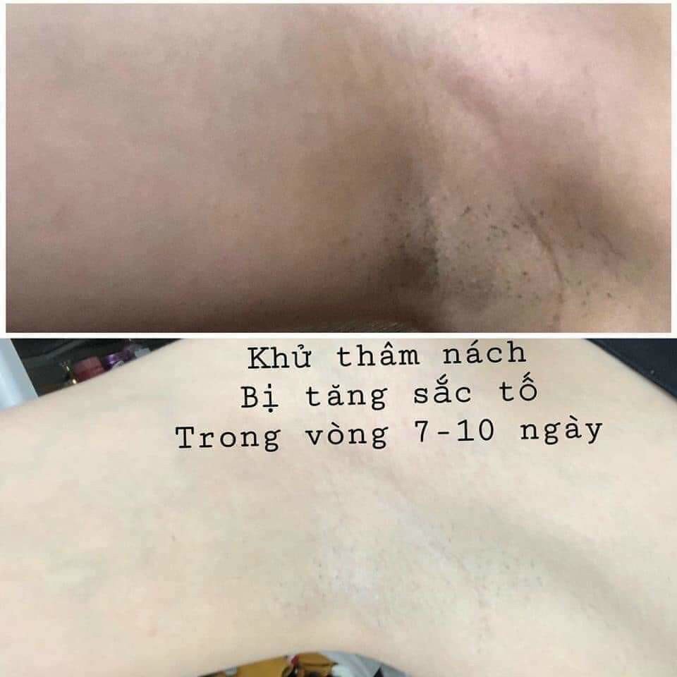 Kem Mờ Thâm Body VIVID WHITE- Nội Địa Hàn Quốc (giảm thâm nách, đầu gối, bikini...) | BigBuy360 - bigbuy360.vn