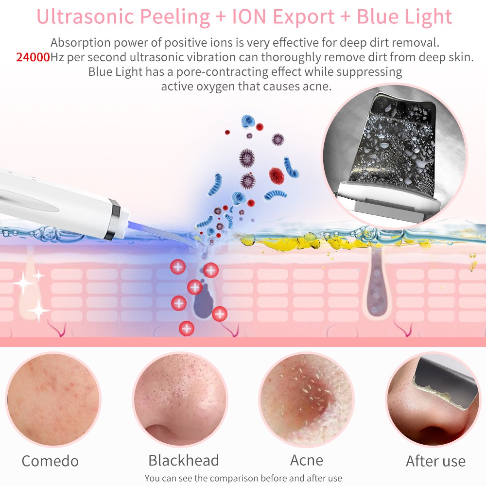 ANLAN Ultrasonic Skin Scrubber Blackhead Removal Machine Deep Cleaning With Red Blue Light