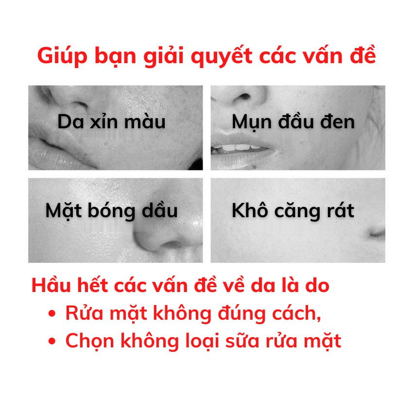 Sữa Rửa Mặt Ngừa Mụn Trắng Da KanJN 100g Sạch Dầu Ngăn Ngừa Mụn KA043 pergolden | BigBuy360 - bigbuy360.vn