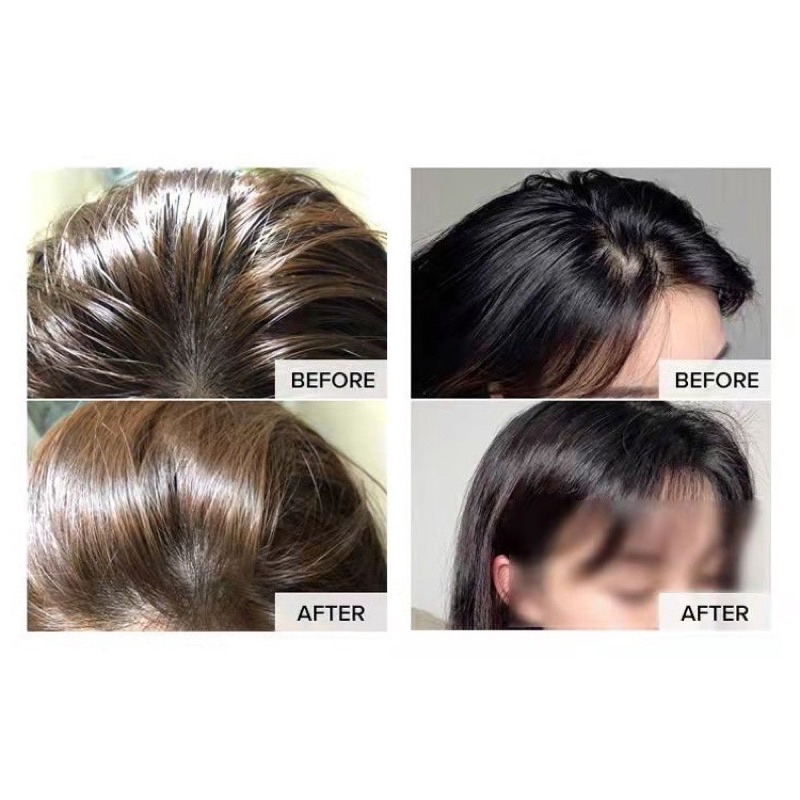 Dầu Gội Xịt Khô Tóc