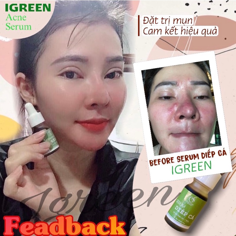 SERUM DIẾP CÁ