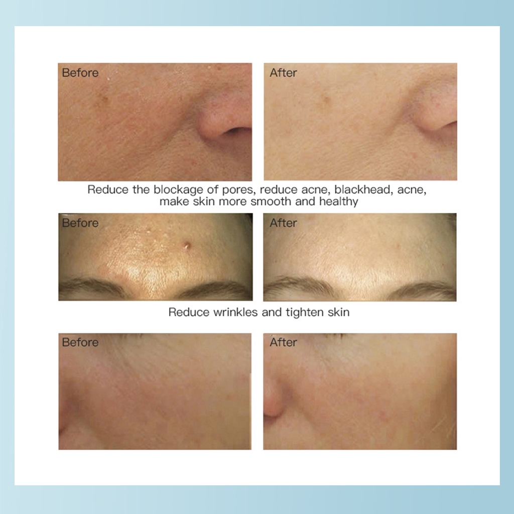 Máy Rửa Mặt KONKA Thiết Kế Nhỏ Gọn Tiện Lợi | BigBuy360 - bigbuy360.vn