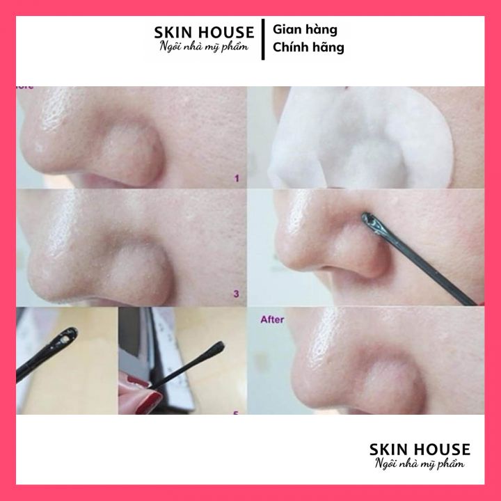 Miếng Dán Lột Mụn Đầu Đen Goodbye BlackHead Ciracle