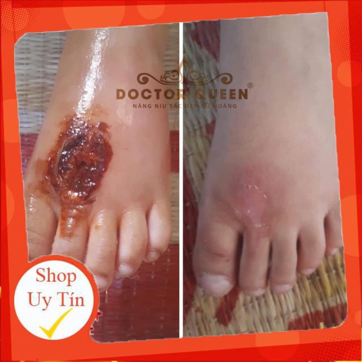 CAO NGHỆ DOCTORQUEEN 🔥𝐍𝐄𝐖🔥