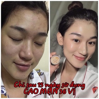 CAO MỤN SÂM ĐỎ 36 VỊ  ( full size 15g) - chính hãng