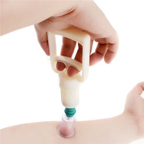 Bộ 12 ly giác hơi không dùng lửa cực kỳ an toàn loại pro