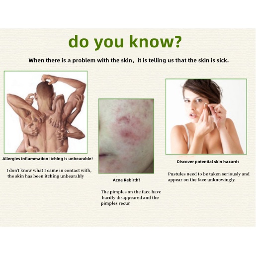 ✌Kho Sẵn Sàng✌Xà Phòng Lưu Huỳnh 85G Hỗ trợ giảm mụn Kiểm Soát Dầu Tẩy Tế Bào Chết Cho Da Mặt