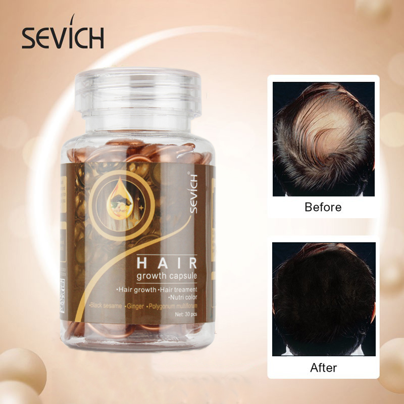 Hộp 30 viên nang SEVICH chứa huyết thanh vitamin dinh dưỡng tăng trưởng chống rụng tóc