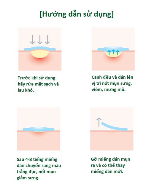 Miếng Dán Mụn Some By Mi Clear Spot Patch (Set 18 miếng)