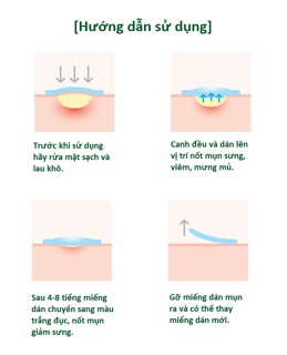 [Nhập khẩu] Miếng Dán Mụn Some By Mi Clear Spot Patch (Set 18 miếng)