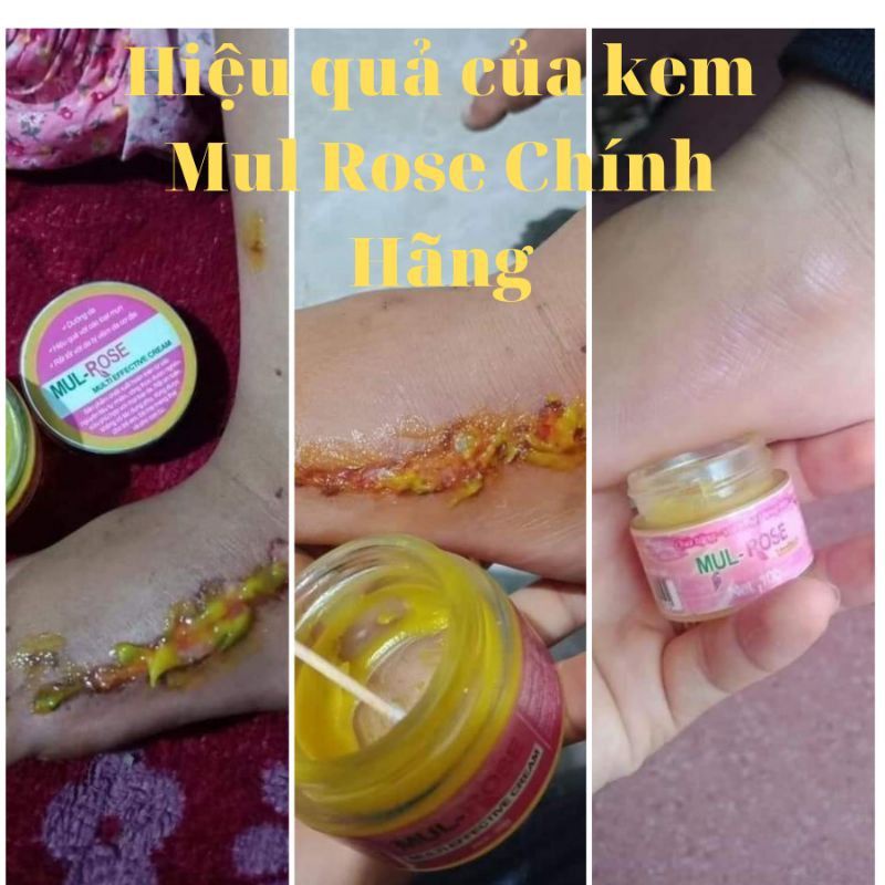KEM NGHỆ ĐA NĂNG MULROSE hộp 30g