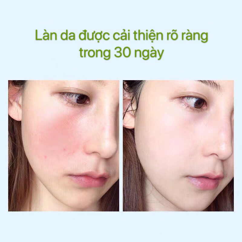 Mặt nạ rau má HIISEES cấp nước phục hồi da giảm thiểu mụn se lỗ chân lông Cleansing Mask HIIS05