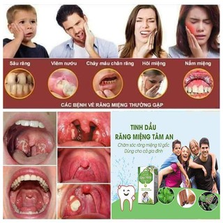 [HÀNG CHÍNH HÃNG]Tinh Dầu Răng Miệng Tâm An