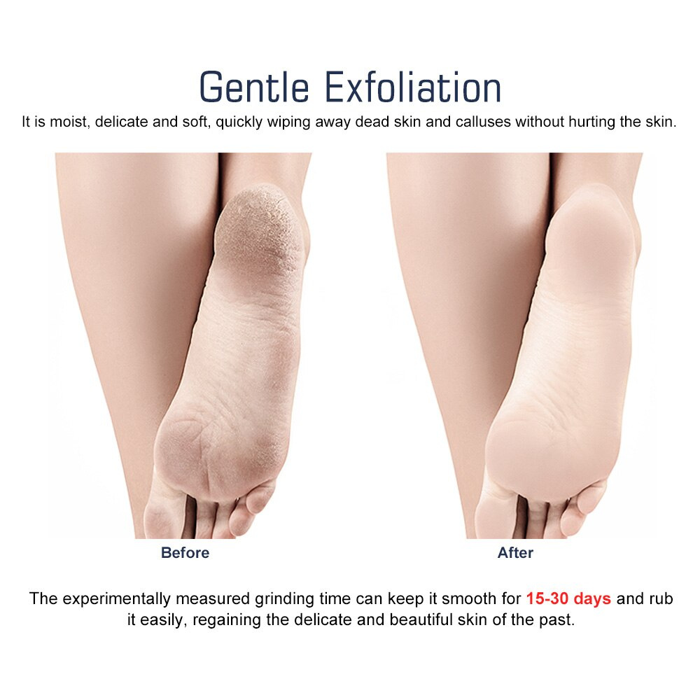 Dũa Chà Gót Chân Suolaer Chăm Sóc Bàn Chân Chuyên Nghiệp