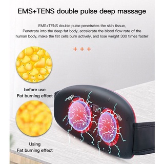 Máy Mát Xa Đốt Cháy Mỡ Bụng Toàn Thân