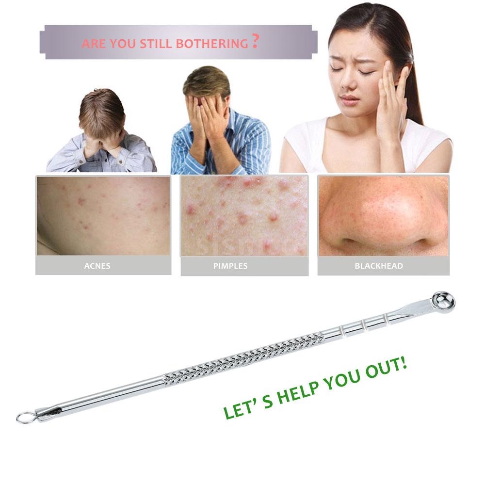 Bộ dụng cụ nặn mụn đầu đen bằng thép không gỉ 12h | BigBuy360 - bigbuy360.vn