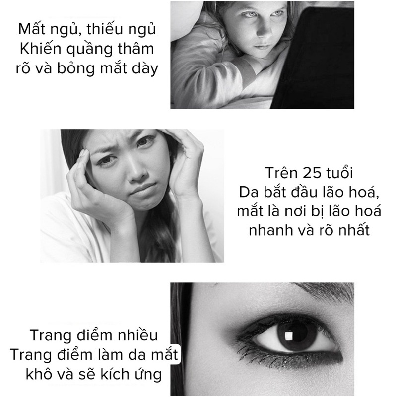 Kem mắt Qiskinbo 20g Dưỡng ẩm và giữ ẩm, giảm quầng thâm và nếp nhăn dưới mắt, dưỡng ẩm vùng mắt