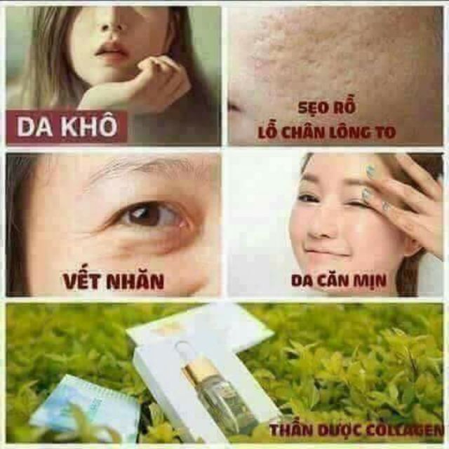 COLLAGEN tươi