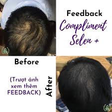 Xịt kích thích mọc - chống rụng tóc COMPLIMENT SELEN+ | BigBuy360 - bigbuy360.vn