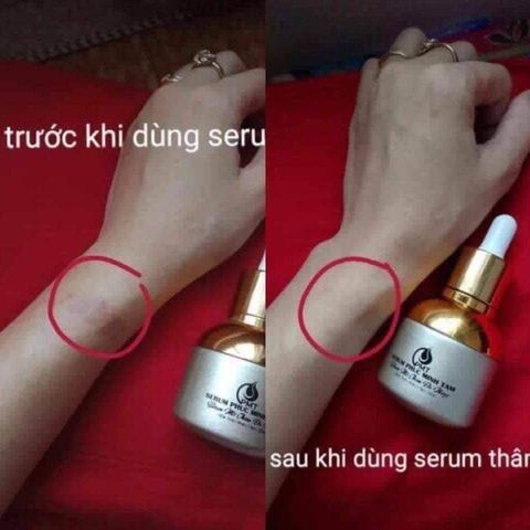 Serum mờ thâm đa năng PMT - Serum mờ thâm Phúc Minh Tâm