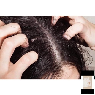 Dầu gội - xả okuto lion dành cho tóc gàu, rụng tóc, tóc yếu ngứa