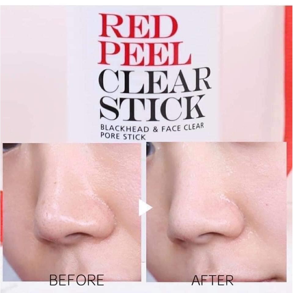 Serum Red Peel Tingle Tái Tạo Phục Hồi Da Sinh Học - Lọ 35ml