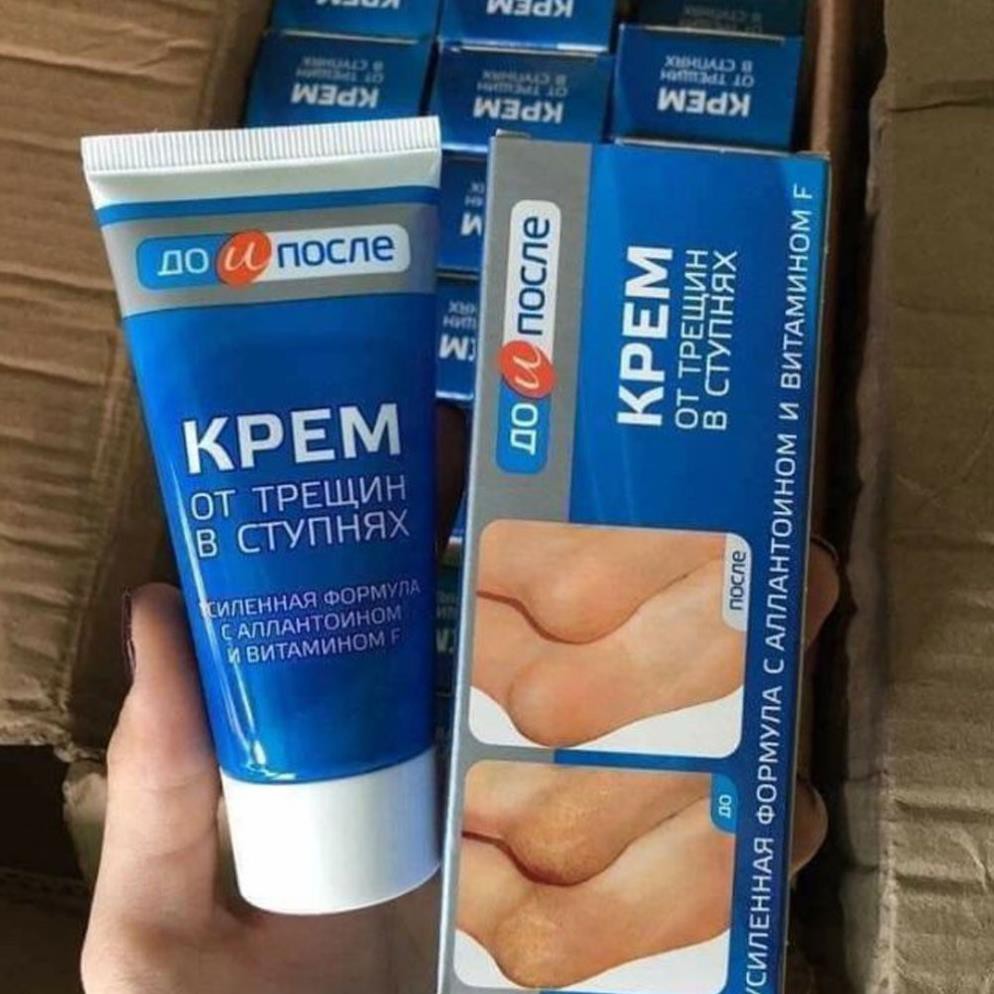 [ Hàng Chính Hãng] Kem Nứt Gót Chân Kpem Nga 50ml