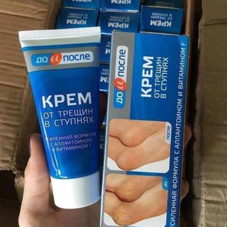 Kem nứt gót chân kpem nga 50ml
