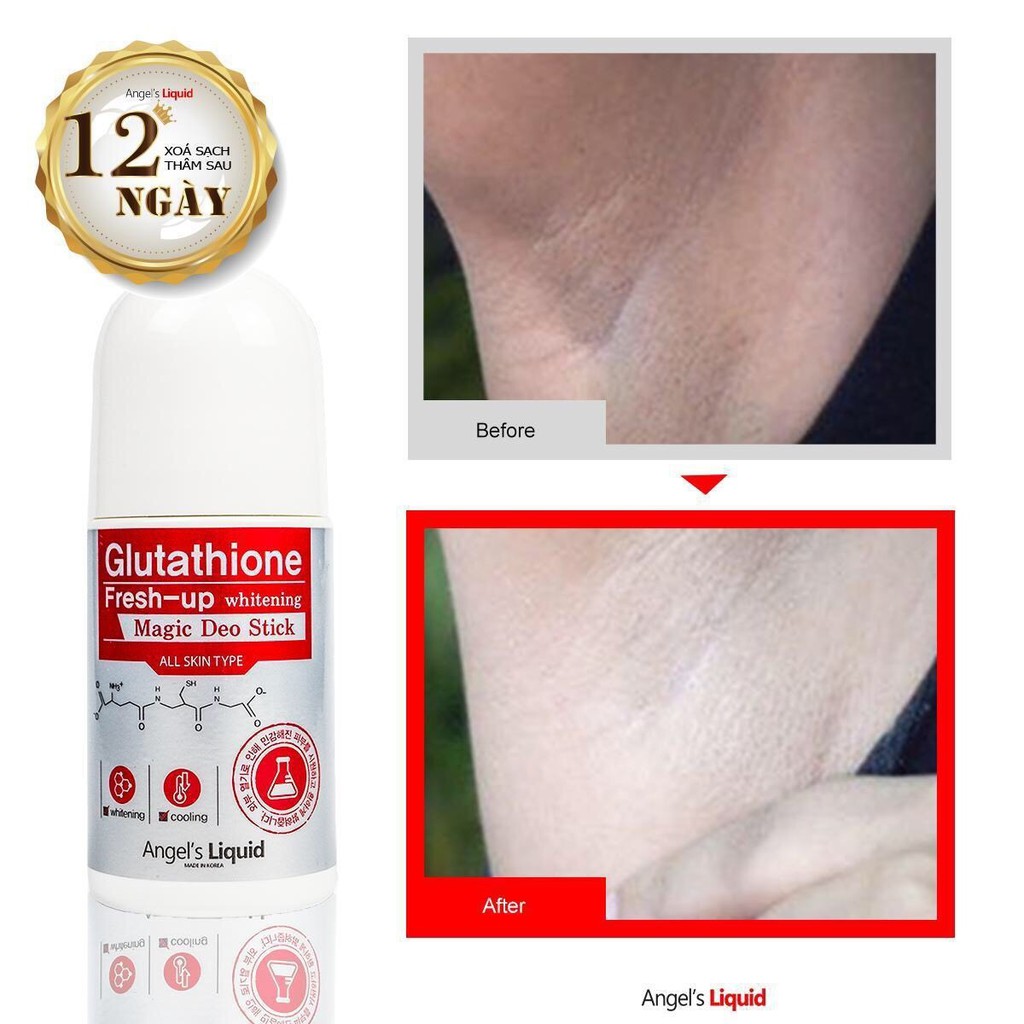 Lăn Nách Ngăn Mùi, Giảm Thâm Vùng Nách Angel’s Liquid Glutathione Fresh-Up Whitening Magic Deo Stick 60ml