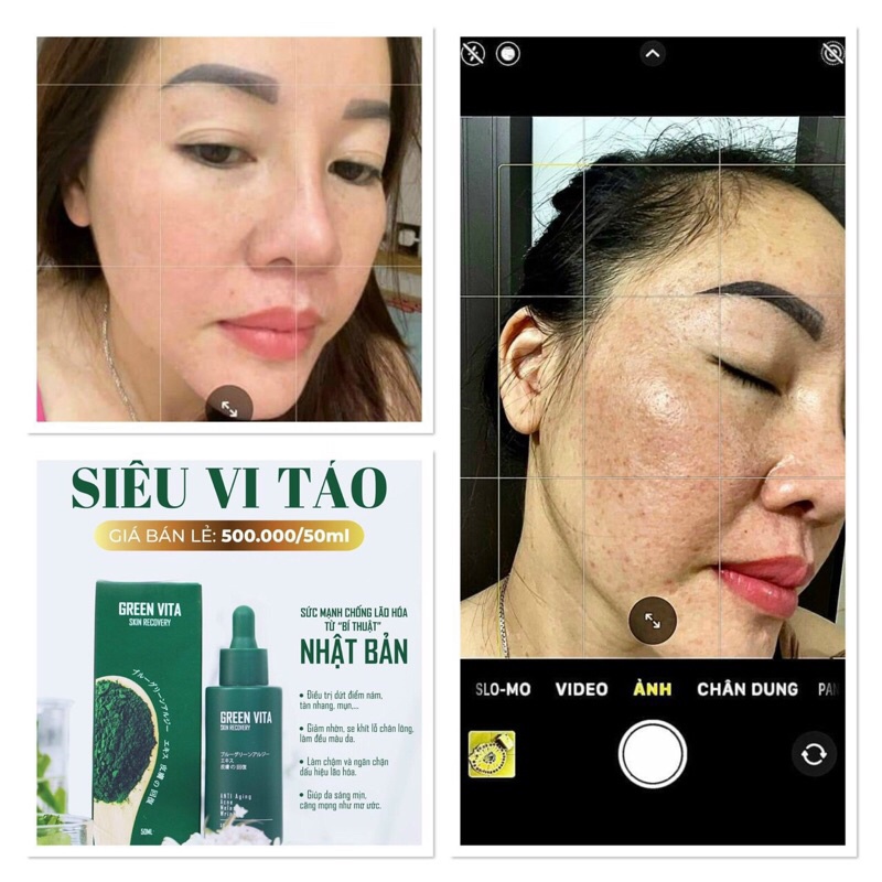 Serum tái sinh da siêu vi tảo Nhật | BigBuy360 - bigbuy360.vn