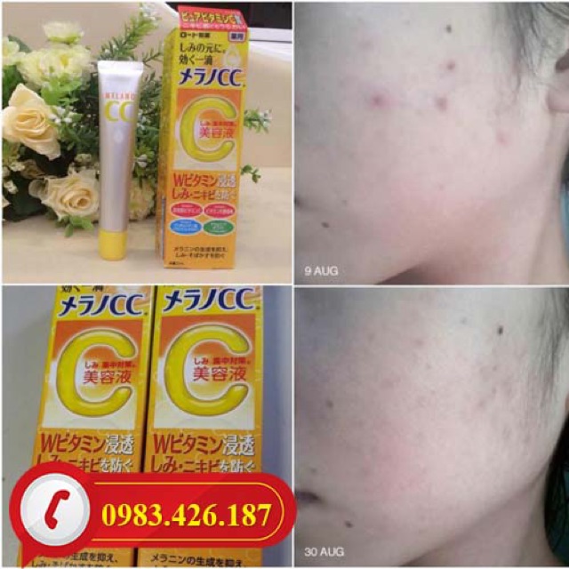 Kem Dưỡng Da Rohto Melano CC Moisture Cream chống thâm nám (23g)