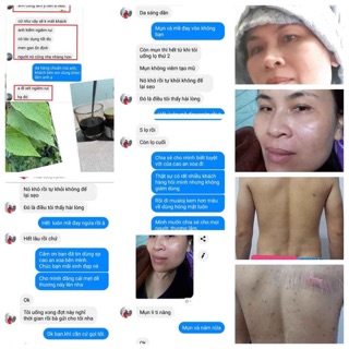 Cao an xoa