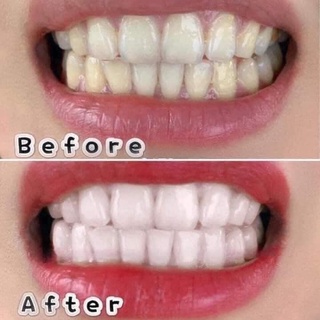 Kem đánh răng Crest 3D White đã về hàng
