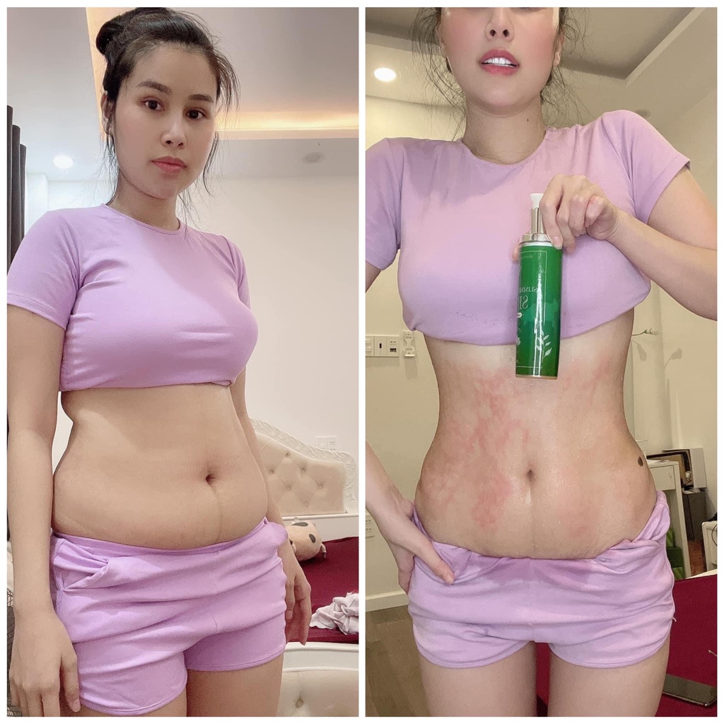 Bộ Ủ Nóng Tan Mỡ Slimming Care Body SB-II Chính Hãng - Giấy Cam Kết