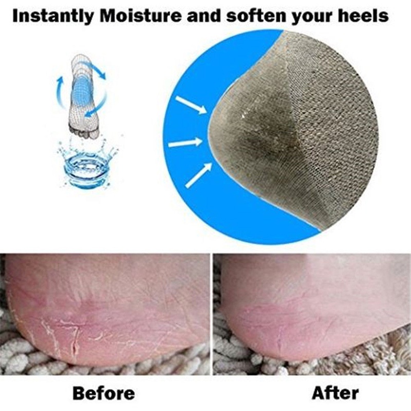 Vớ gel silica dưỡng ẩm chăm sóc bàn chân