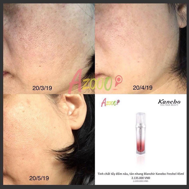 TINH CHẤT TẨY ĐỐM NÂU, TÀN NHANG BLANCHIR 45ml | BigBuy360 - bigbuy360.vn