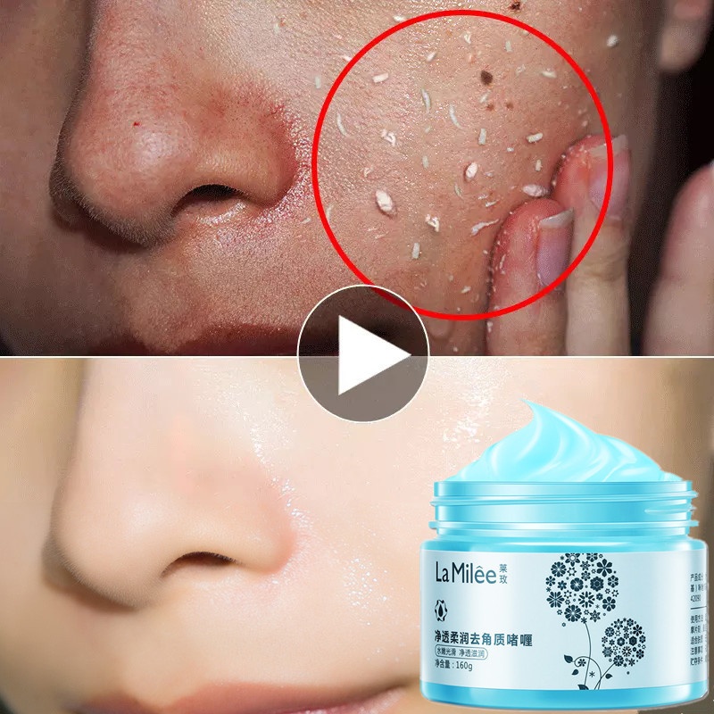 Gel Tẩy Tế Bào Chết Thu Nhỏ Lỗ Chân Lông Toàn Thân Chất Lượng Cao | BigBuy360 - bigbuy360.vn